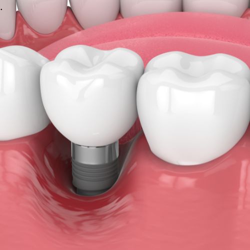 Best Dentistry in Perinthalmanna